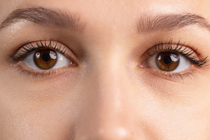 Ojos inflamados: Descubre las señales y qué hacer para desinflamarlos.-Ópticas Lafam